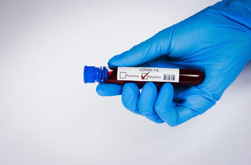 Hand holds a test tube containing a blood negative sample, test tube with blood for Covid-19 (coronavirus) analyzing. Laboratory testing patient’s blood. Blue nitrile glove.