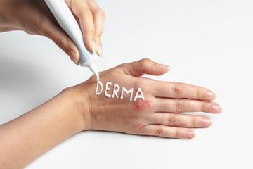 Girl smears eczema cream on her hands isolate on white background. Skin diseases, dermatitis, eczema, psoriasis, dry skin, cracked skin and redness. Place under the text.