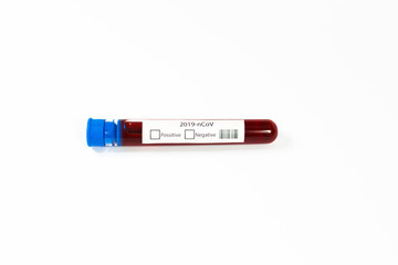 Blood test samples for the presence of a coronavirus (COVID-19) tube containing a blood sample to be tested for the coronavirus.