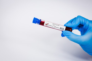 Hand holds a test tube containing a blood positive sample, test tube with blood for Covid-19 (coronavirus) analyzing. Laboratory testing patient’s blood. Blue nitrile glove.