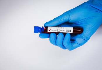 Hand holds a test tube containing a blood positive sample, test tube with blood for Covid-19 (coronavirus) analyzing. Laboratory testing patient’s blood. Blue nitrile glove.
