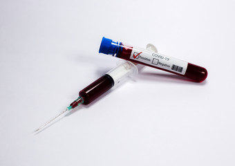 Test tube with blood sample Covid-19 (coronavirus). Laboratory blood test. syringe with blood....