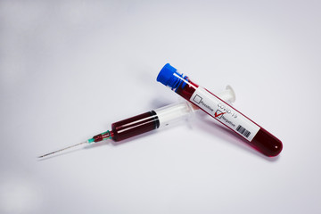 Test tube with blood sample Covid-19 (coronavirus). Laboratory blood test. syringe with blood. 
Covid-19 (coronavirus) negative test tube.

