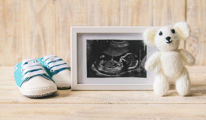 Ultrasound picture of a baby's photograph and accessories. Selective focus.