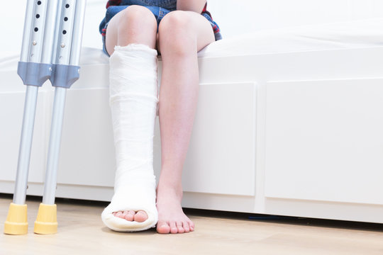 Close-up of children's feet, one leg is broken and in a cast, next to crutches. Light background.