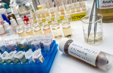 Samples contaminated by Clostridium botulinum toxin that causes botulism in humans, laboratory research, conceptual image