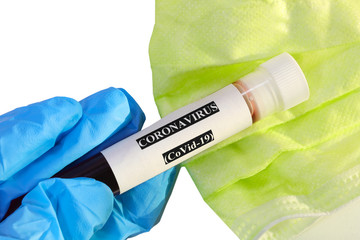 blood sample in the test tube to verify the serological test for