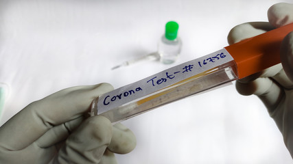 Obraz premium Corona virus testing in lab holding swab sample in hands