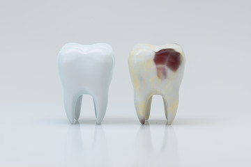 The decayed tooth beside with the white tooth, 3d rendering.
