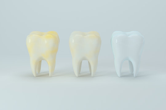 Changing of the tooth color from yellow to white, 3d rendering.