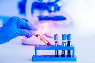 Hand of doctor wearing medical protective gloves and holding sampling tube with blood sample