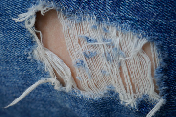 Torn denim pants, hole in the pants.