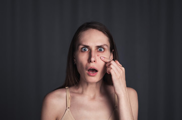 Portrait of a shocked girl who saw a large red pimple on her face. Female looking at camera with a problem pimple on her face.