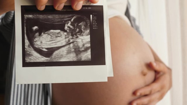 pregnant woman strokes her belly shows ultrasound picture to camera