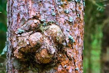 Huge excrescence on pine tree trunk. Sick diseased forest tree. color