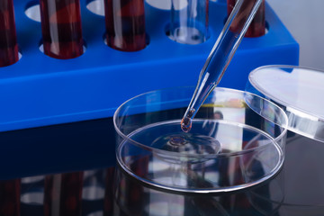 blood test for viruses in a Petri dish while creating a new vaccine