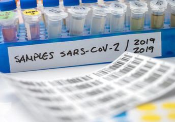 Vials with samples of SARS-COV-2 Covid-19 in a research laboratory, conceptual image