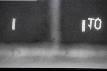 X-ray image of the welding seam with defects