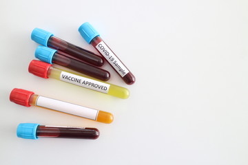 vaccine sample of covid-19 or corona virus