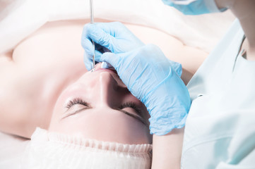 Close-up Mechanical face peel at the beautician. Beautician squeezes acne on the patient's forehead with a medical needle. Face next to hands in blue gloves of cosmologist