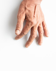 Trigger Finger a defect in a tendon causing a finger to jerk or snap straight when the hand is extended.