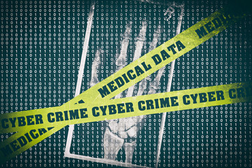 Cyber Crime Medical Data