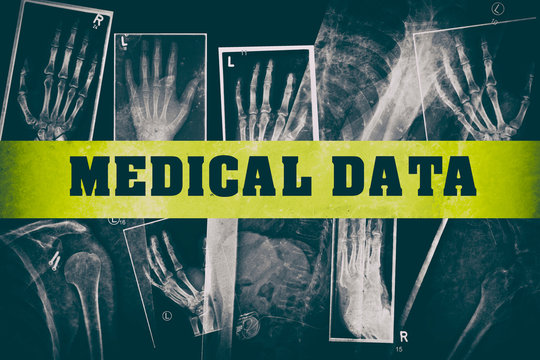 Medical Data mit Röntgenaufnahmen