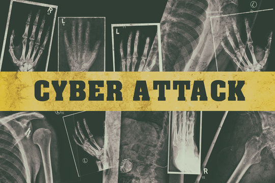 Cyber attack with medical data and xray images