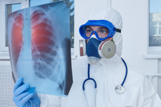  picture of the lungs of a patient