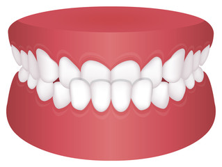 Teeth trouble ( bite type ) vector illustration /Underbite