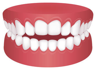 Teeth trouble ( bite type ) vector illustration  /Open bite