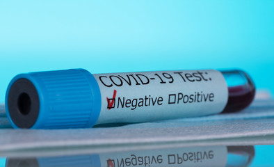 Test tube with a negative blood test for coronavirus. Macro photo on a blue.