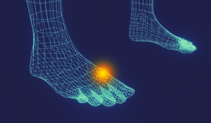 Blue contour and red-yellow spots of pain. Low-poly element for medicine and orthopedics