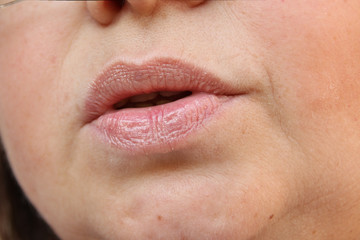 lips, mouth and chin of a middle-aged woman, part of the face close-up, fine wrinkles on the face, spots, the concept of cosmetic anti-aging procedures, facial massage