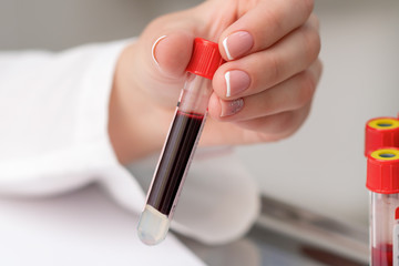 Close up of doctor's hand holding test tube with blood sample in the lab.