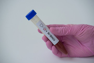 Obraz premium A hand holding a tube with blood positive COVID-19. Coronavirus test. horizontal orientation. White background.