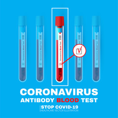 Coronavirus Blood Test. Realistic 3D test tube with blood. 2019-nCoV medical background. Virus Covid 19-NCP. Coronavirus nCoV. Positive and negative testing for COVID.
