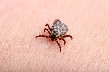 Lyme Disease Infected Tick Mite Insect Crawling on Skin. Encephalitis Virus or Lyme Borreliosis Infectious Dermacentor Tick Arachnid Parasite Close-up