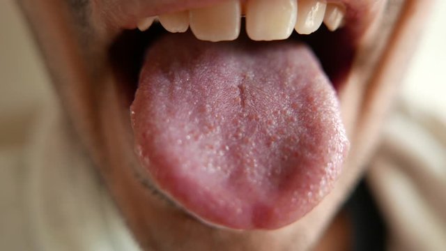 Macro closeup on a man's wide open mouth showing teeth and his tongue into the camera