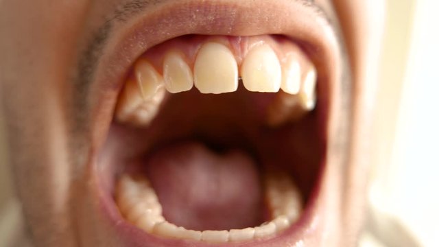 Macro closeup shot of a man's mouth screaming  and yelling into the camera showng teeth
