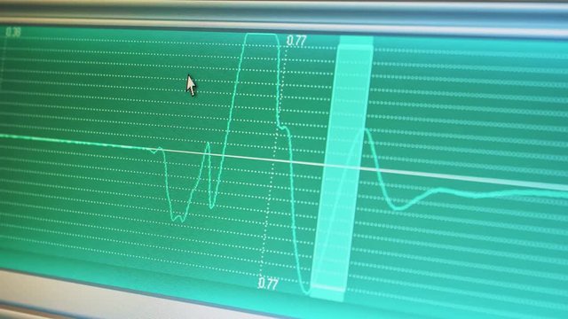 Monitor screen with the image of high-frequency waves. Analysis and diagnostics. The equipment allows you to check the correctness of the design of the circuit, to identify and eliminate faults.