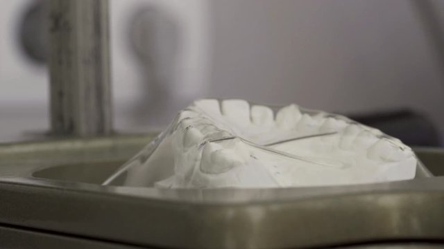 Making A Invisalign Retainer By Moulding Thermoplastic Material On A Plaster Cast Of The Maxillary Jaw Through Vacuum Suction - Close Up
