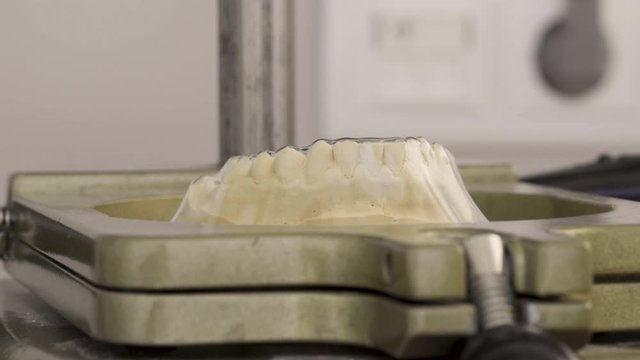 Making A Invisalign Retainer By Moulding Thermoplastic Material On A Plaster Cast Of The Mandibular Jaw Through Vacuum Suction - Close Up