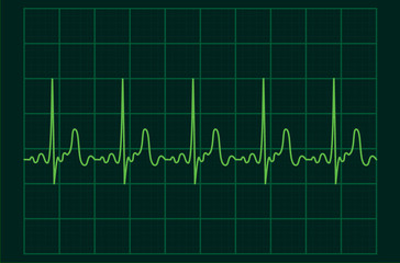 ECG heartbeat monitor, cardiogram heart pulse line wave. Electrocardiogram medical background.	