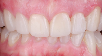 The various styles of intra-oral photograph