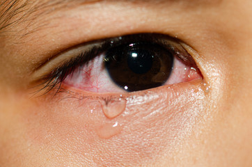 .The child is cryingใ