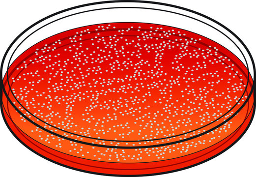 Petri Dish With Red Culture Medium And Bacterial/virus Colony.