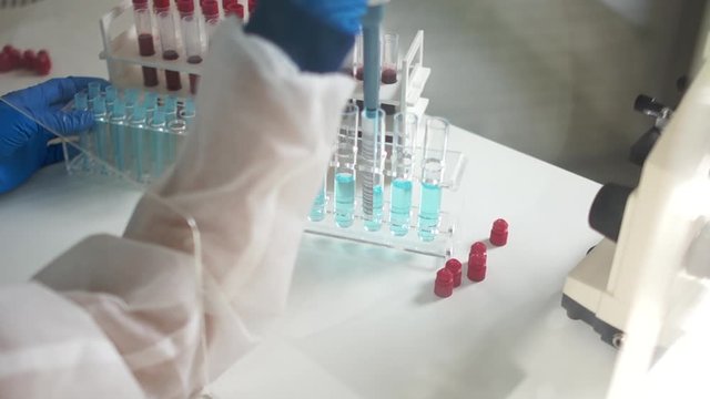 Close-up of a laboratory assistants hand of a woman in a protective suit doing research with blood samples of a virus infected. Diagnosis of coronavirus covid-19 in the laboratory