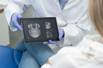 Dentist showing teeth x-ray on tablet screen