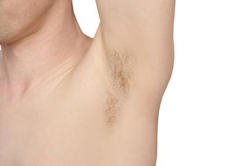 Girl underarm. White man armpit. Before epilation collage. Wax depilation result concept. Laser hair removal. sugaring spa procedure. Health care home routine. IPL treatment. Isolated